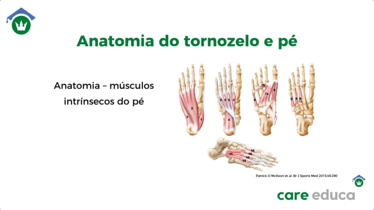 CareEduca_EntorseTornozelo (8)